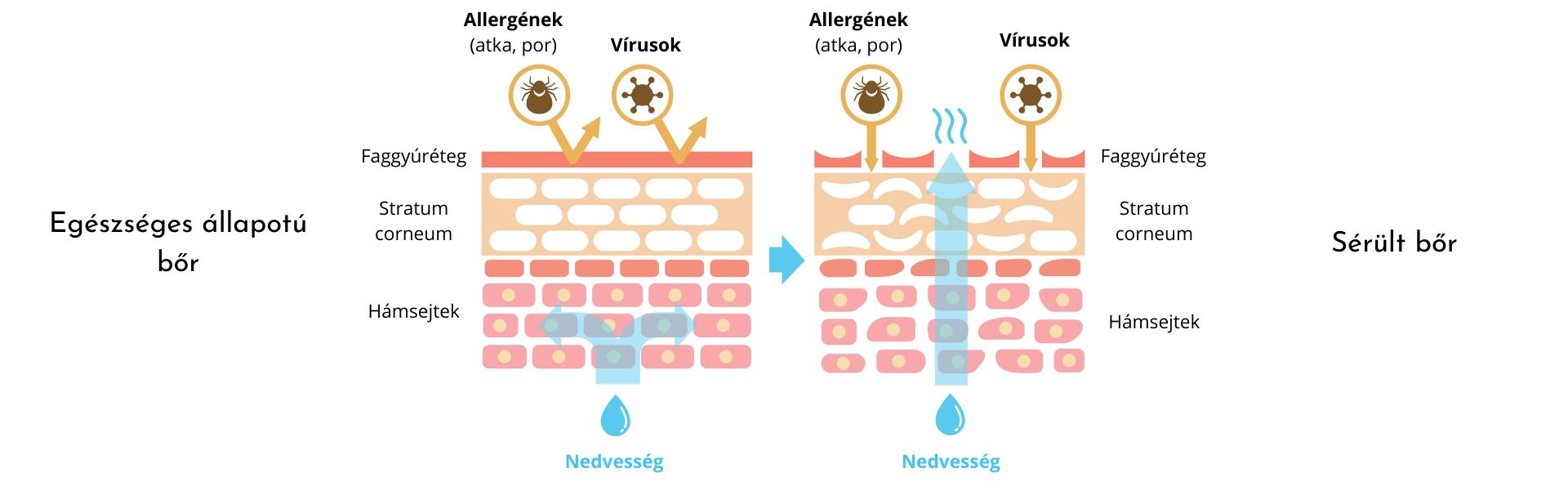Egészséges bőr barrier