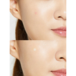 Kép 2/2 - Cosrx Acne Pimple Master Patch Pattanás elleni tapasz